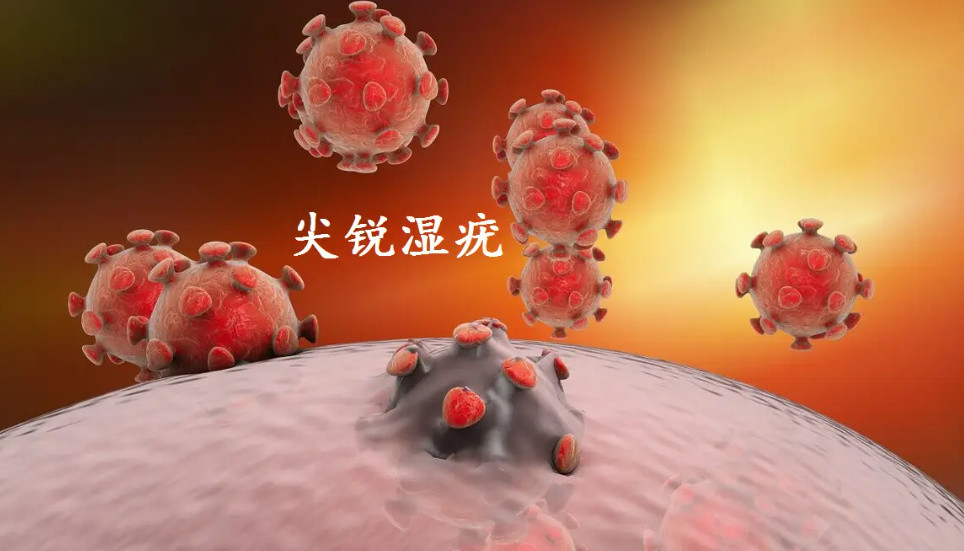 网红夫妇哈尔滨就餐引争议，口腔有“菜花”真的是尖锐湿疣吗？